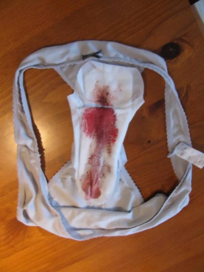 Bloody Girl Porn - girls getting fucked on bloody period xxx - XXXPicz